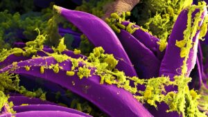 Yersinia pestis bacteria